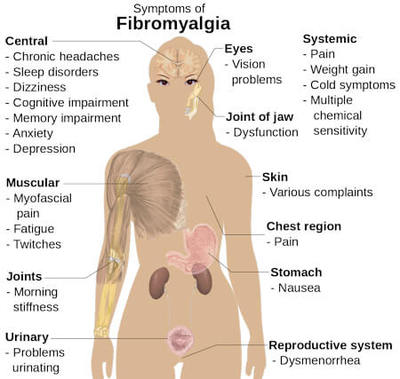 What are the signs and symptoms of fibromyalgia?